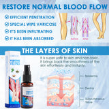 30ml Varicose Vein Spray Multi-Purpose Knee And Leg Care Spray Promote Blood Circulation